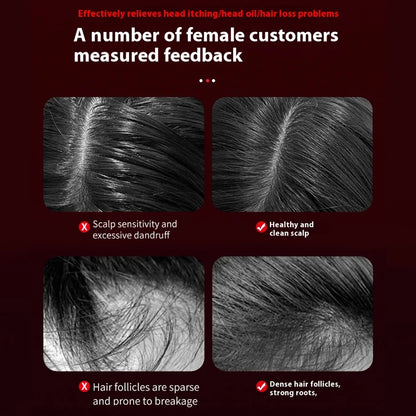 Electric Scalp Massager with Red Light Therapy