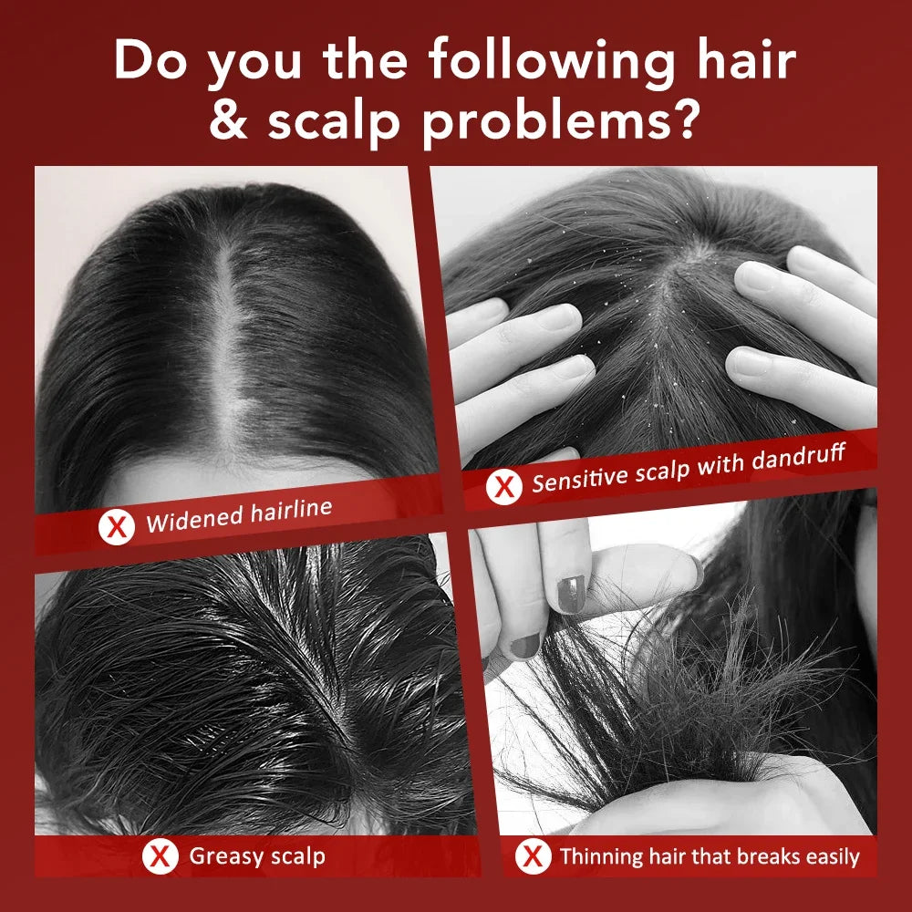 Electric Scalp Massager with Red Light Therapy